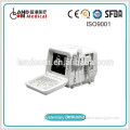 Veterinary Digital Ultrasonic Diagnostic Imaging System with CE